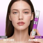 Dark Spot Remover for Face and Body, Age Spot Sun Spot Freckles Remedy... - Image 4