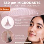 OMMA Korean Microdart Pimples Patch, Cystic Pimples Therapy, Micropoint Pi... - Image 3