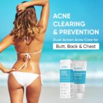 Butt Zits Clearing Remedy Cream: Clears & Prevents Breakouts Quick –... - Image 6