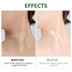 Peaq Firming Neck Cream, Peaq Ah-8 Neck Firming Cream, Neck Tightening... - Image 7