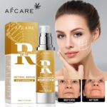 Superior 1% Retinol Serum for Face – Anti-Growing older, Darkish Spot Corrector &... - Image 3