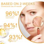 Superior 1% Retinol Serum for Face – Anti-Growing older, Darkish Spot Corrector &... - Image 5