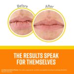 O'Keeffe's Lip Restore SPF 35 Lip Balm - Stick (1 Pack) - Solar-Secure Mois... - Image 3