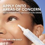 innisfree Bija Spot Serum with Salicylic Acid & Castor Oil, Korean Tre... - Image 6