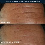 RoC Derm Correxion Fill + Deal with Superior Retinol Serum, Wrinkle Filler... - Image 4