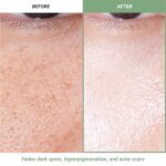 Meebak Korean Vitamin C Serum | Brightening Darkish Spot Remover | Soothi... - Image 5