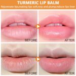 Turmeric Lip Balm for Darkish Lips with Turmeric Oil, Darkish Lips Therapy... - Image 6