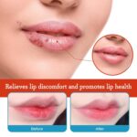 Dry Cracked Lips - Pure Therapeutic Lip Balm, Natural All-Day Moisture ... - Image 3