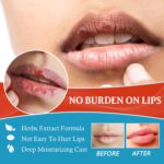 Dry Cracked Lips - Pure Therapeutic Lip Balm, Natural All-Day Moisture ... - Image 4