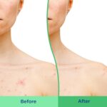 Differin Physique Scrub with Salicylic Acid Zits Clearing Improves Tone an... - Image 5