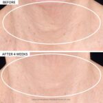 StriVectin Tighten & Carry Superior LIGHT Neck Cream for Neck & Décolle... - Image 5