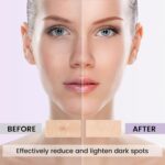 Darkish Spot Remover for Face and Physique,Darkish Spot Corrector for Age Spots ... - Image 4