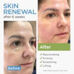 Collagen Face Cream with Stem Cells Retinol Hyaluronic Acid Niacinamid... - Image 3