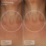 Senté Firming Neck Cream for Crepey Pores and skin & Vertical Traces | Lifts, Fir... - Image 5