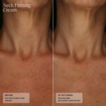 Senté Firming Neck Cream for Crepey Pores and skin & Vertical Traces | Lifts, Fir... - Image 6