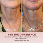 ABERA Nano Collagen Neck Cream, Even Tone & Anti-Wrinkle with Niacinam... - Image 6