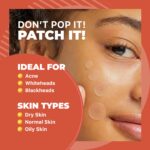 ROSELYNBOUTIQUE Pimple Patches for Face 300 Counts 4 Sizes Hydrocolloi... - Image 3