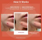 ROSELYNBOUTIQUE Pimple Patches for Face 300 Counts 4 Sizes Hydrocolloi... - Image 6