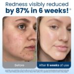 Clear Pores and skin Membership Clear Towels XL®, 100% USDA Biobased Face Towel, Dispo... - Image 4