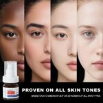 SINPIN aobenz Darkish Spot Remover for Face & Physique | Superior Corrector S... - Image 4