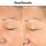 Trustworthy Magnificence Ageless Agency and Even Serum | Powered by Vegan Collagen ... - Image 4