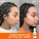 Palmer's Pores and skin Success Further Energy Tone Correcting Face Serum, 1.0 F... - Image 4