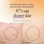 DERMA E Zits Spot Remedy, Zits Blemish Management Remedy Serum, 2 F... - Image 4