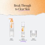 DERMA E Zits Spot Remedy, Zits Blemish Management Remedy Serum, 2 F... - Image 6