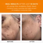 Andalou Naturals Darkish Spot Corrector, Complexion Enhancing Face Serum ... - Image 4