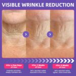 Neck Firming Cream with Curler | Formulated with Retinol, Collagen & N... - Image 8