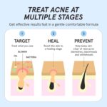 HERBIVORE Blue Wave Clearing Serum Pimples Remedy | 2% Salicylic Acid ... - Image 5