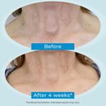 Plexaderm Twin Motion Restore 1% Retinol Neck Cream. Anti Growing old Cream w... - Image 5