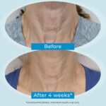 Plexaderm Twin Motion Restore 1% Retinol Neck Cream. Anti Growing old Cream w... - Image 6