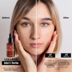 LULLAGE Bio10 Forte Intensive Darkish Spot Corrector Face Serum for All S... - Image 4