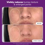 Paula's Alternative CLINICAL 20% Niacinamide Vitamin B3 Concentrated Face S... - Image 5