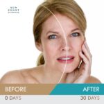 Darkish Spot Diminisher, DermaBright MD, Age Spot Solar Spot Freckles Melas... - Image 4