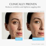 Retinol Anti Getting old Face Moisturizer: Wrinkle Cream for Girls, Collagen... - Image 6