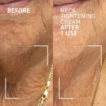 Dr. Brandt Needles No Extra Neck Tightening Cream - Lifts, Tightens & R... - Image 3
