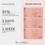Butt Pimples Clearing Remedy Cream: Physique Pimples Remedy Lotion for Fol... - Image 3