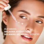 Abera Melasma Serum Plus, Melasma Therapy for Face, Darkish Spot Correc... - Image 4