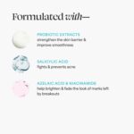 TULA Pores and skin Care Clear Pores and skin Starters Zits & Blemish Combating Discovery Okay... - Image 4