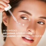 Abera Melasma Serum, Melanin Correcting Facial Serum, Darkish Spot Correc... - Image 4