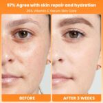 20% Vitamin C Face Serum with Golden Mixture of Hyaluronic Acid an... - Image 5