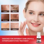 Darkish Spot Remover for Face and Physique - Darkish Spot Corrector Serum for Ac... - Image 3