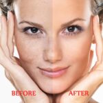 Darkish Spot Remover for Face and Physique - Darkish Spot Corrector Serum for Ac... - Image 4