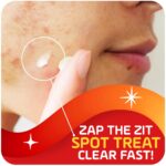 Asepxia 2% Salicylic Acid Zits Spot Therapy Cream | Drying System T... - Image 3