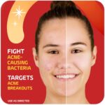 Asepxia 2% Salicylic Acid Zits Spot Therapy Cream | Drying System T... - Image 5