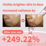 Niacinamide Serum Darkish Spot Corrector with Fermented Strawberry Juice ... - Image 3