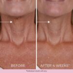 DEKLIDERM Neck Firming Cream – Anti Ageing Retinol Cream Visibly Scale back... - Image 5