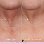 DEKLIDERM Neck Firming Cream – Anti Ageing Retinol Cream Visibly Scale back... - Image 6